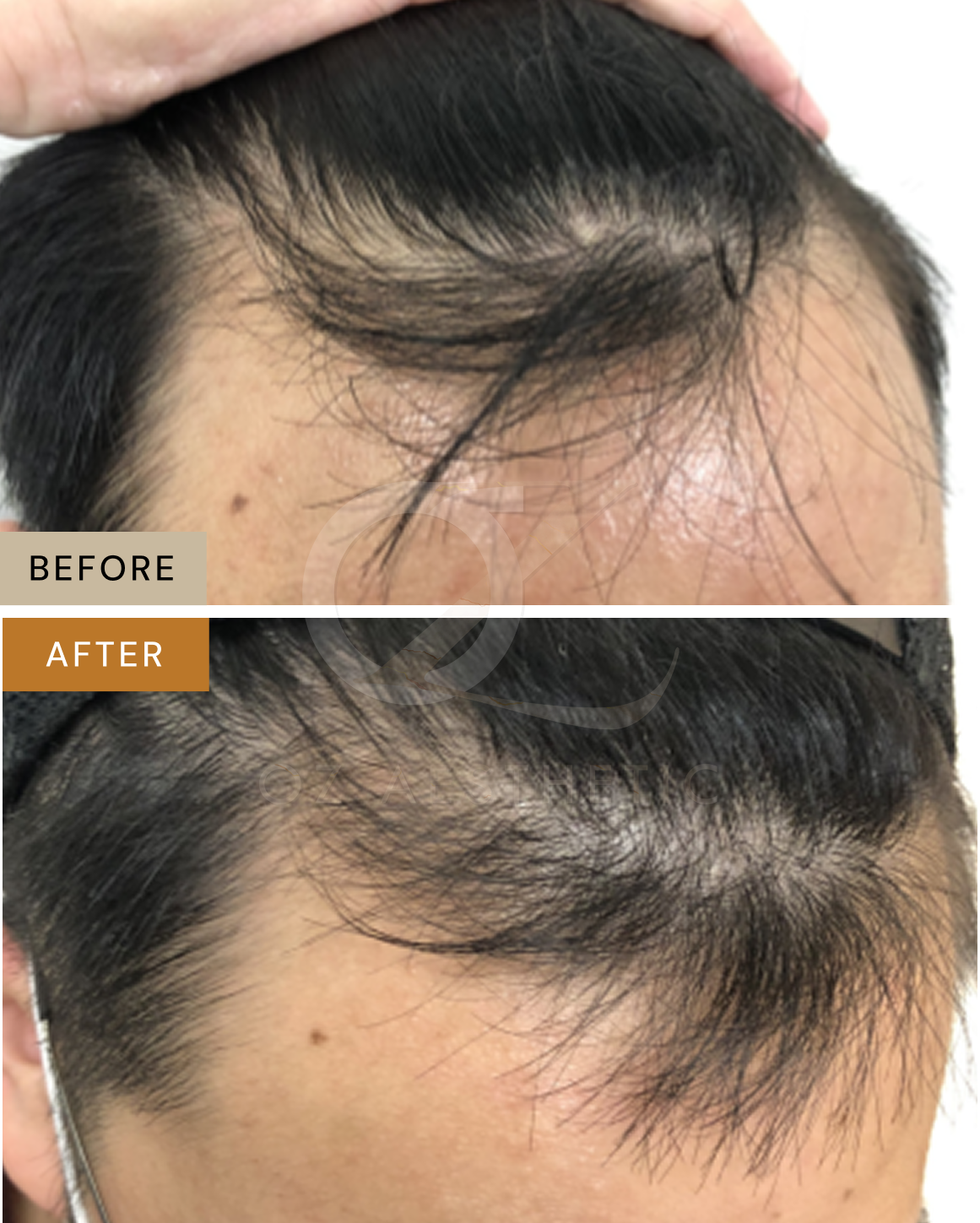 hair-1.png