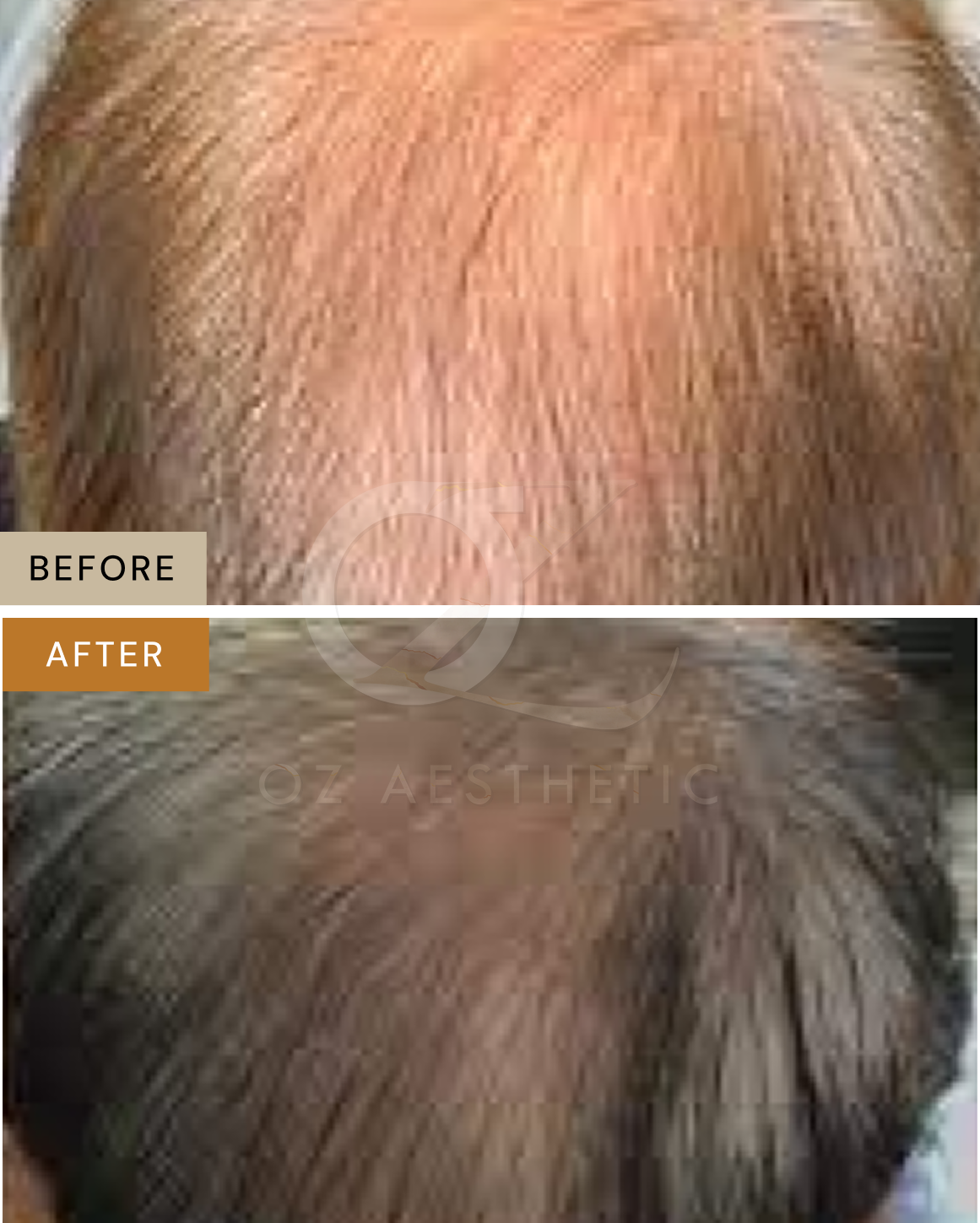 hair-2.png