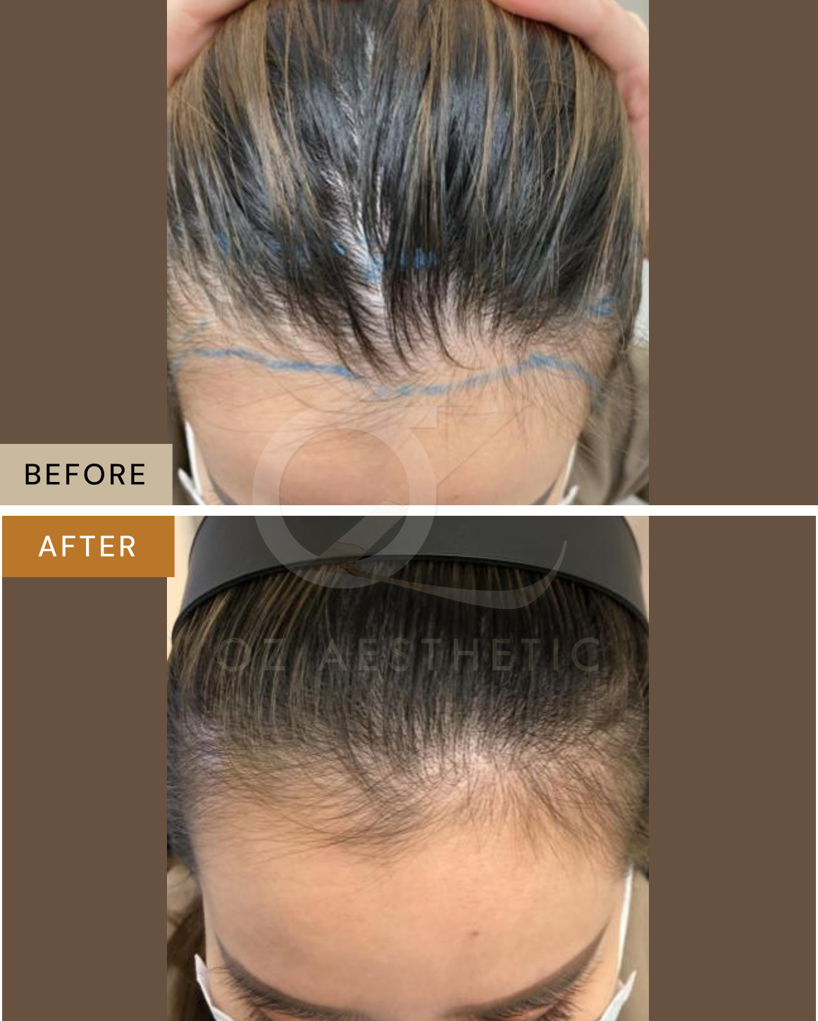 hair-4.png